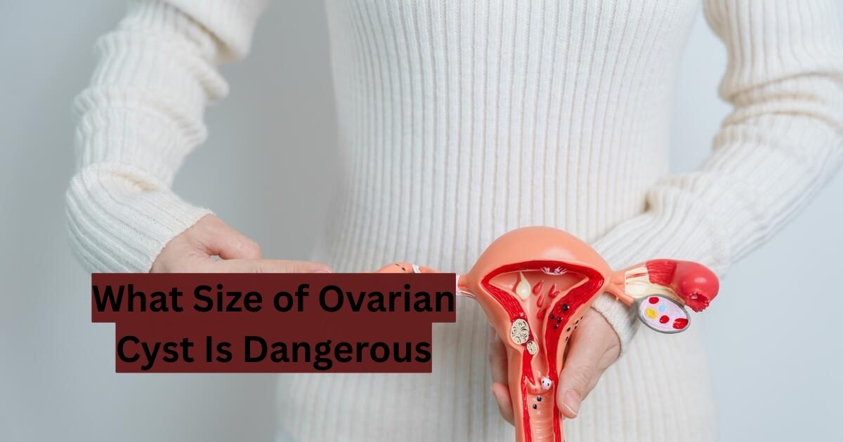 What Size of Ovarian Cyst Is Dangerous